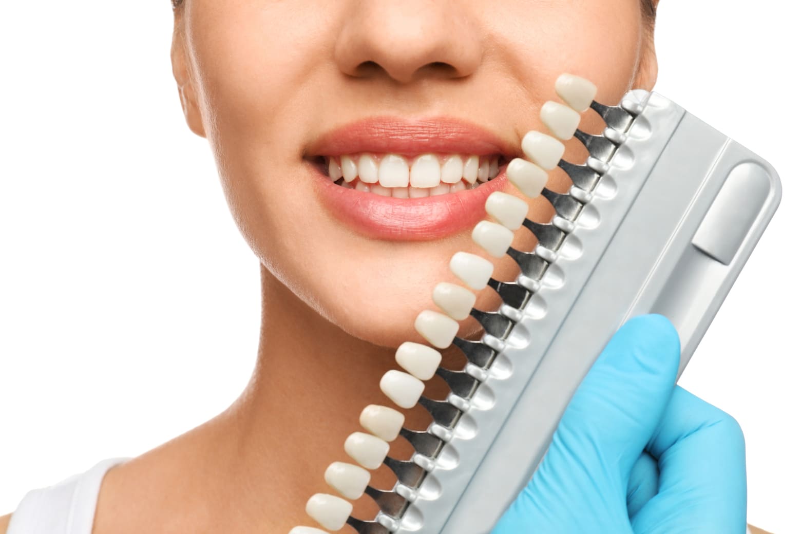 Dental shade guide held beside a woman’s smile to compare tooth colors.